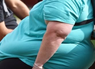 La obesidad, enfermedad que más afecta a la población entre los 18 a 64 años