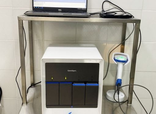 Equipos de alta tecnología para detectar Tuberculosis